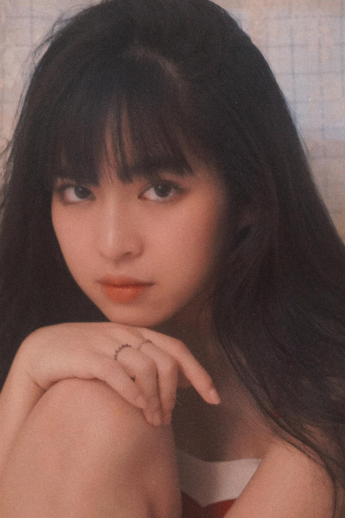 Nhật ký niềng răng của Khánh Vân 'Mắt Biếc' hai tuần đầu đầy 'sóng gió' và những chuyện dở khóc dở cười! Ảnh 4