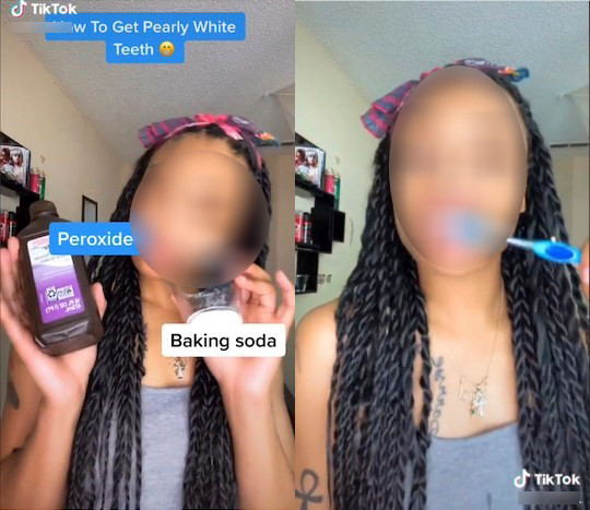 Nhiều người dùng TikTok khác đã bắt đầu học theo mẹo này để làm trắng răng mà không hề biết rằng bản thân mình đang gặp nguy hiểm. (Ảnh: TIKTOK/@TIKLIKEDALLAS/Dazeddigital)