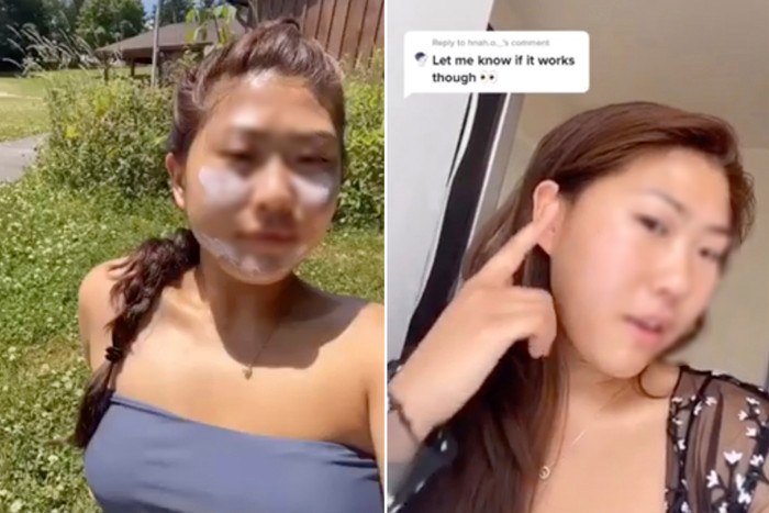 theo Tiến sĩ Vishal Madan, người đang làm việc tại phòng khám da liễu Stratum cho biết, điều này có thể khiến da bị bỏng, lão hóa hoặc rủi ro ung thư cao hơn. (Ảnh: TikTok/New York Post)