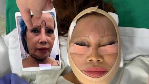 'Cô dâu 62 tuổi' chuẩn bị đi phẫu thuật nâng ngực? Ảnh 3