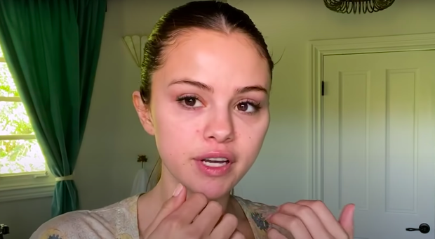 Dù rằng bị vài nốt mụn nhưng điều này không hề làm giảm đi nét đáng yêu của cô nàng