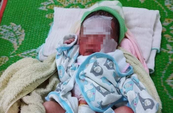 Bé gái sơ sinh hiện đã ổn định. Ảnh: P.H/Zing