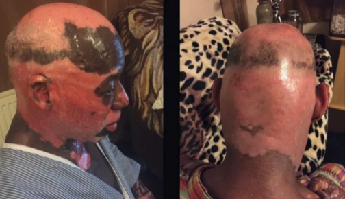  Bệnh tật ngày một trầm trọng khiến ông không tiếp tục làm việc được nữa.