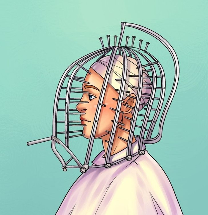 7 phát minh làm đẹp điên rồ và nguy hiểm đã từng gây sốt trong quá khứ Ảnh 1