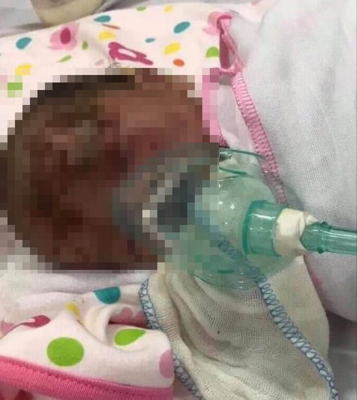 Cháu bé được theo dõi trong bệnh viện. 