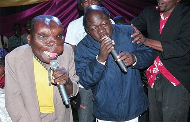 'Người đàn ông xấu xí nhất thế giới' gây bất ngờ khi công khai cưới vợ lần 3 Ảnh 3