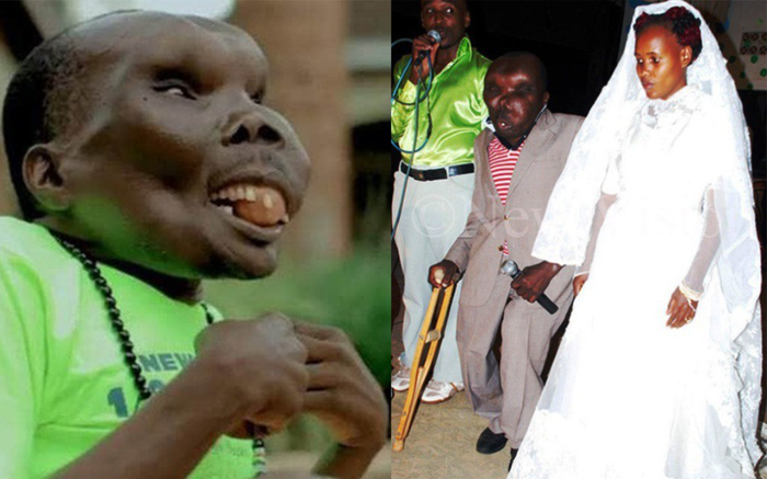 'Người đàn ông xấu xí nhất thế giới' gây bất ngờ khi công khai cưới vợ lần 3 Ảnh 2