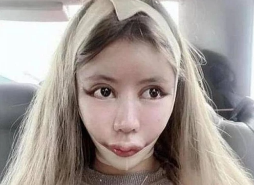 Cô gái chấp nhận đau đớn để phẫu thuật hơn 100 lần cho giống búp bê.