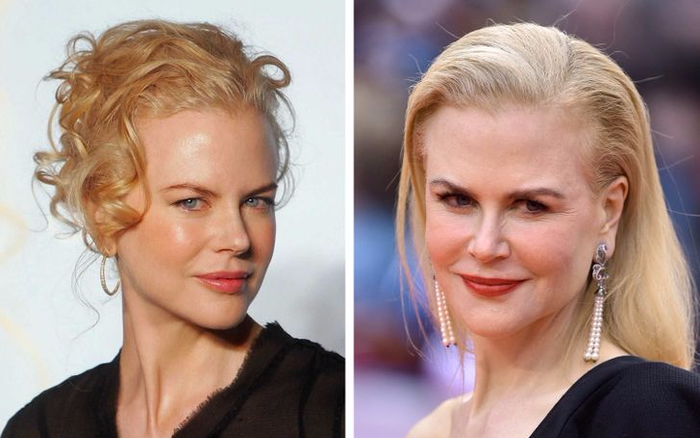 9 vị trí không thể che giấu trên khuôn mặt sẽ tiết lộ tuổi thật của phụ nữ Ảnh 2