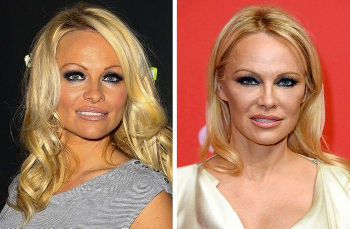 9 vị trí không thể che giấu trên khuôn mặt sẽ tiết lộ tuổi thật của phụ nữ Ảnh 6