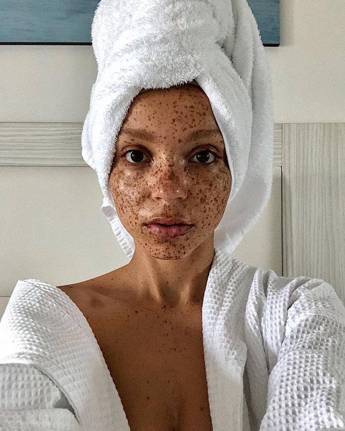 Coral Kwayie 26 tuổi đến từ Vương quốc Anh tự hào với gương mặt tàn nhang. Cô không bao giờ dùng kem che khuyết điểm để giấu đi đặc điểm tự nhiên của mình.  