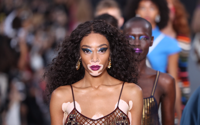 14 người mẫu có vẻ đẹp độc lạ làm thay đổi thế giới thời trang Ảnh 2