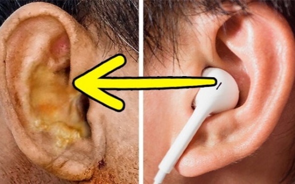 Vì sao bạn không bao giờ nên dùng chung tai nghe với người khác? Ảnh 2