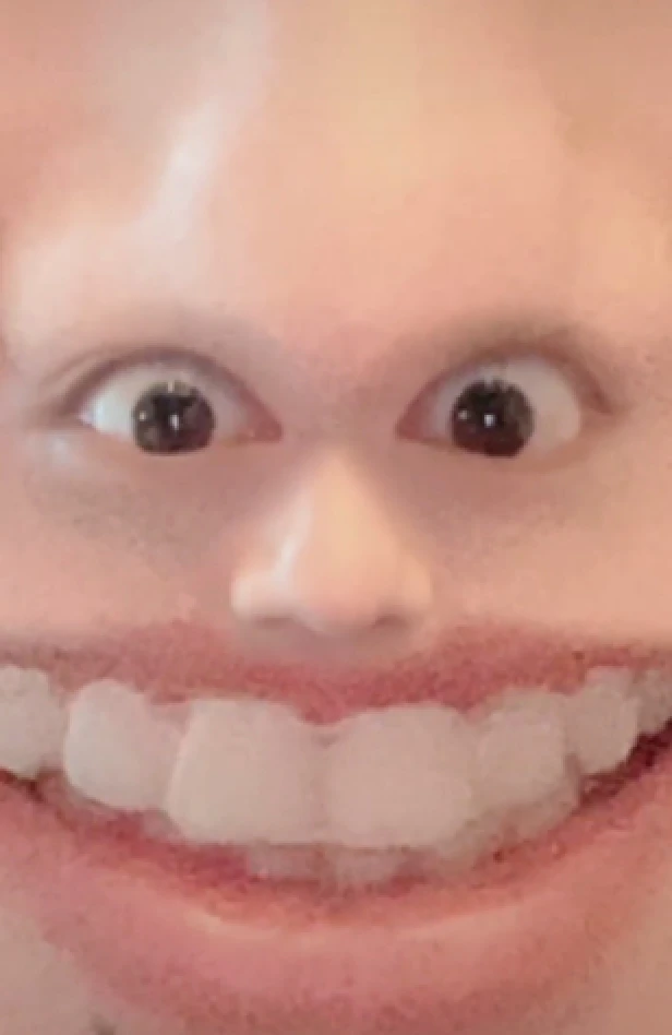 Đăng video mừng kỷ niệm 4 năm debut, Tiêu Chiến khiến fan bất ngờ khi đến hiện tại vẫn còn niềng răng Ảnh 2