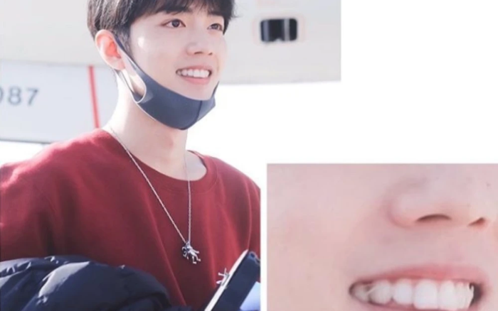 Đăng video mừng kỷ niệm 4 năm debut, Tiêu Chiến khiến fan bất ngờ khi đến hiện tại vẫn còn niềng răng Ảnh 2