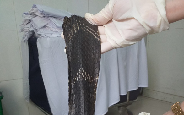 Thêm một người bị rắn hổ mang chúa cắn phải tháo đốt ngón tay Ảnh 2