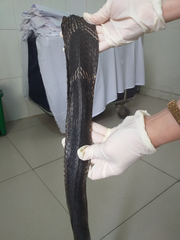 Con rắn cắn anh K. phải nhập viện. 