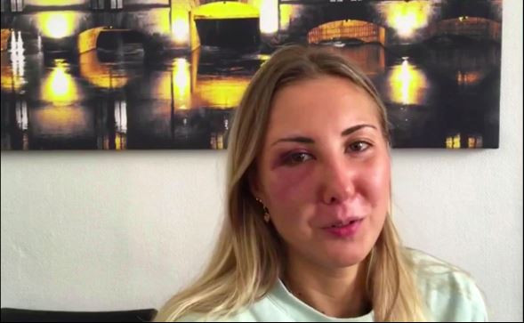 Elisabeth, cô gái bị đánh chỉ vì mặc váy ngắn đi trên đường. 