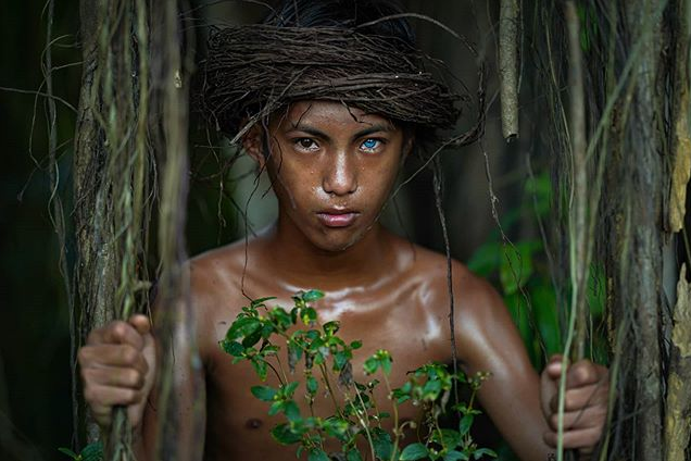 Bộ lạc mắc hội chứng hiếm gặp khiến màu mắt xanh như biển sâu Ảnh 7