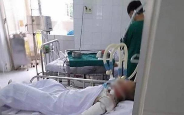 Thiếu nữ 15 tuổi bị bạn trai tạt xăng thiêu sống đã tử vong Ảnh 2