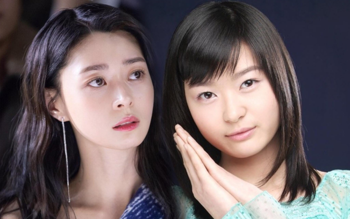 'Nữ nhân của Lee Jong Suk' Kwon Nara dính phốt phẫu thuật thẩm mỹ để giống vợ Won Bin Ảnh 2