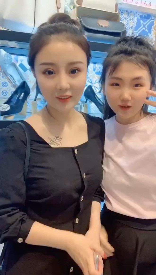 Hotgirl 'hói đầu' vì ăn ngô bằng khoan, công khai hình ảnh 'dao kéo' khiến fan quay lưng Ảnh 10