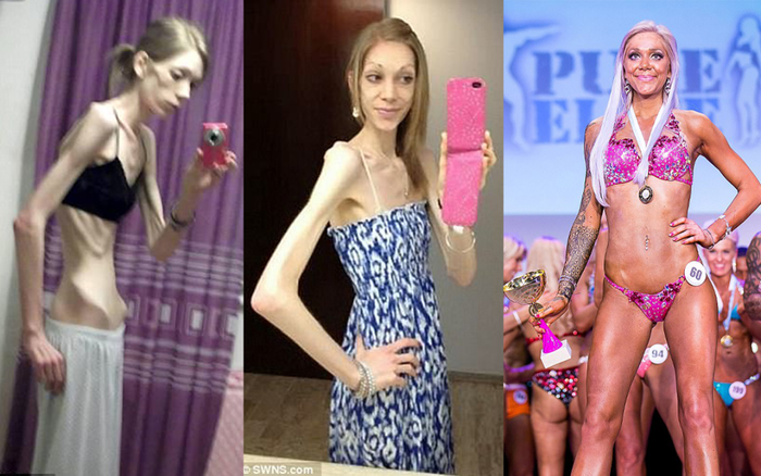 Từng bị ví như bộ xương di động, cô gái bất ngờ 'lột xác' với vóc dáng nóng bỏng sau 18 tháng làm điều này Ảnh 2