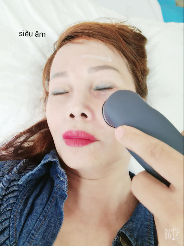 Gặp biến chứng thẩm mỹ, 'cô dâu 62 tuổi' phải chạy vật lí trị liệu nhưng khẳng định sẽ tiếp tục ước mơ làm đẹp Ảnh 5