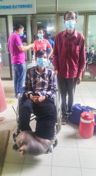 Bị muỗi đốt, chàng trai phải sống với một bên chân sưng phù 'quái dị' suốt 21 năm Ảnh 5