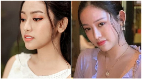 So ảnh cũ của Thuý Vi với hình ảnh hiện tại mà người ta không khỏi tiếc nuối bởi số tiền và công sức cô bỏ cho phẫu thuật thẩm mỹ không hề nhỏ. Gương mặt rạng rõ, xuất thần ngày nào bây giờ trả lại là sự mệt mỏi, kém sắc. &nbsp;