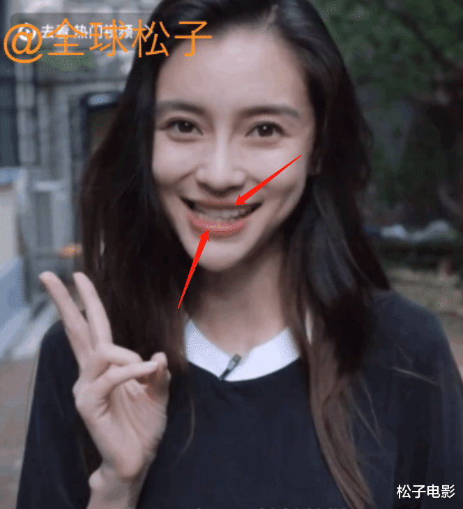 Angelababy bị nghi ngờ gặp biến chứng thẩm mỹ: Khuôn mặt cứng đơ, nhan sắc đáng báo động! Ảnh 4