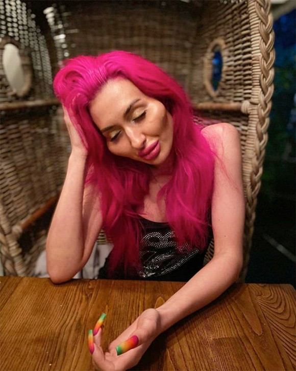 Suốt 4 năm, cô nàng 'chăm chỉ' tiêm filter