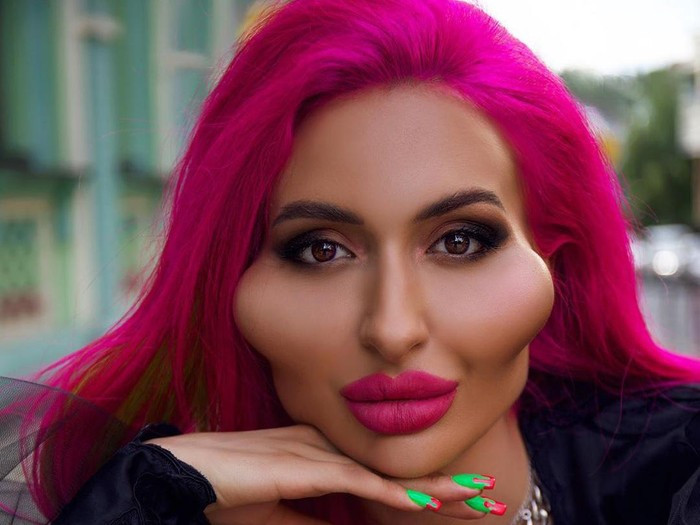 'Nghiện' tiêm filter suốt 4 năm, nàng mẫu có 'gò má cao nhất thế giới' vẫn thấy chưa 'đủ đô' Ảnh 8