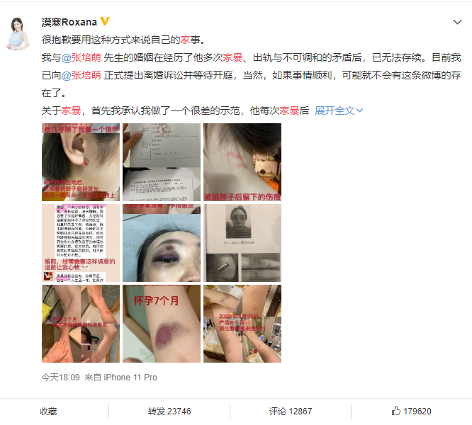 Nữ MC giữ lại nhiều bằng chứng thể hiện chồng bạo hành