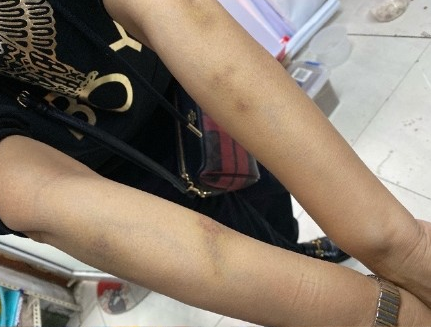 VĐV điền kinh nổi tiếng bị tố ngoại tình, đánh đập vợ, lời giải thích sau đó khiến dân mạng phẫn nộ Ảnh 9