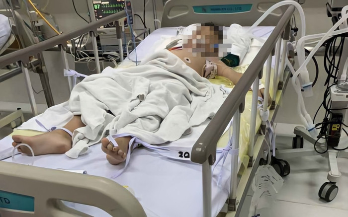 Bé K. được cấp cứu tại Bệnh viện Nhi đồng 2. (Ảnh: Tuổi trẻ)