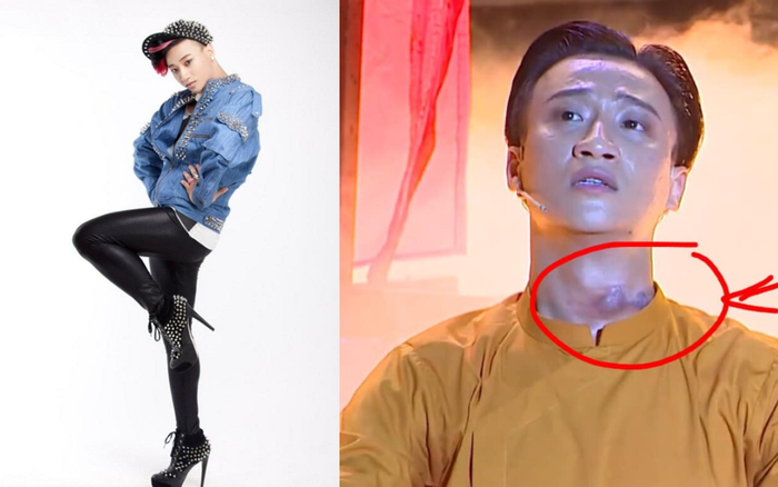 Dancer Tô Lâm bất ngờ chia sẻ bệnh lao hạch, Đại Nghĩa - Lý Nhã Kỳ động viên Ảnh 2