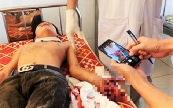 Đang học bài, laptop bất ngờ phát nổ khiến 3 học sinh nhập viện cấp cứu Ảnh 2