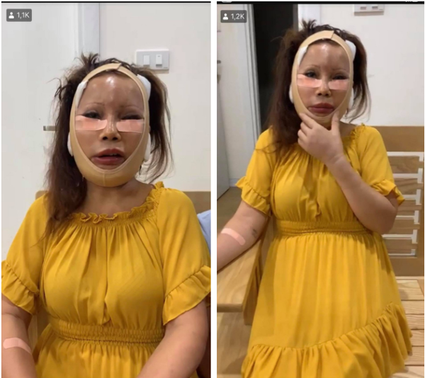 'Cô dâu 62 tuổi' gây bất ngờ với diện mạo mới sau thời gian vật lý trị liệu vì biến chứng phẫu thuật Ảnh 4