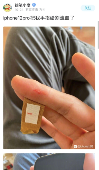 Người dùng này bị đứt tay vì chiếc iPhone 12 Pro mới mua. Ảnh chụp màn hình