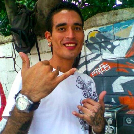 Rodriguez cách đây 11 năm trước khi phẫu thuật.&nbsp;