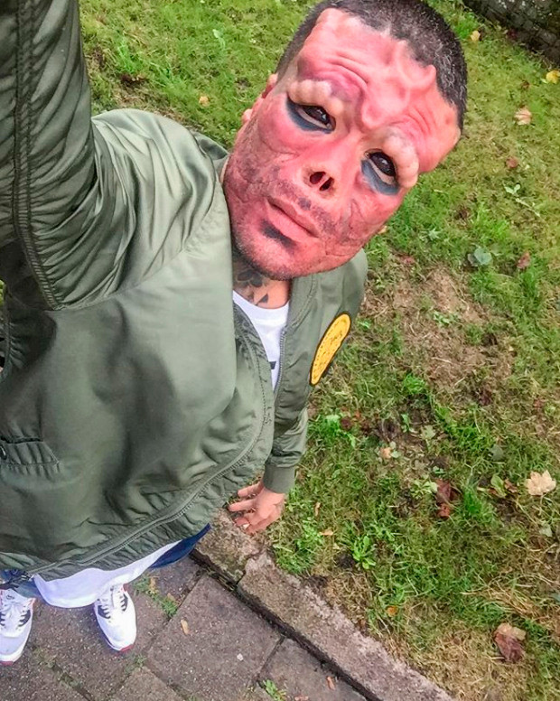 Các cuộc phẫu thuật của Rodriguez bao gồm cắt mũi và dái tai, cấy ghép silicon vào trán, má và lông mày.&nbsp;