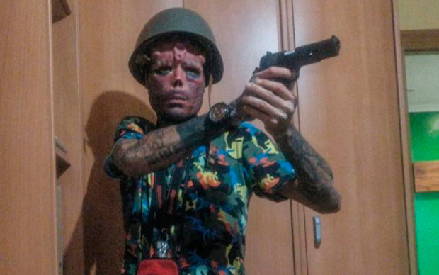 Để giống Red Skull trong phim Marvel, người đàn ông chịu đau đi cắt mũi, cấy ghép sừng Ảnh 2