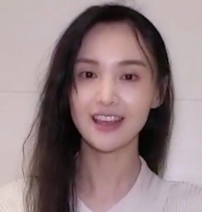 Nhiều cư dân mạng còn tỏ ra lo lắng khi nhìn đường chân tóc hiện tại của cô và cho rằng đây là dấu hiệu của việc bị rụng tóc nhiều