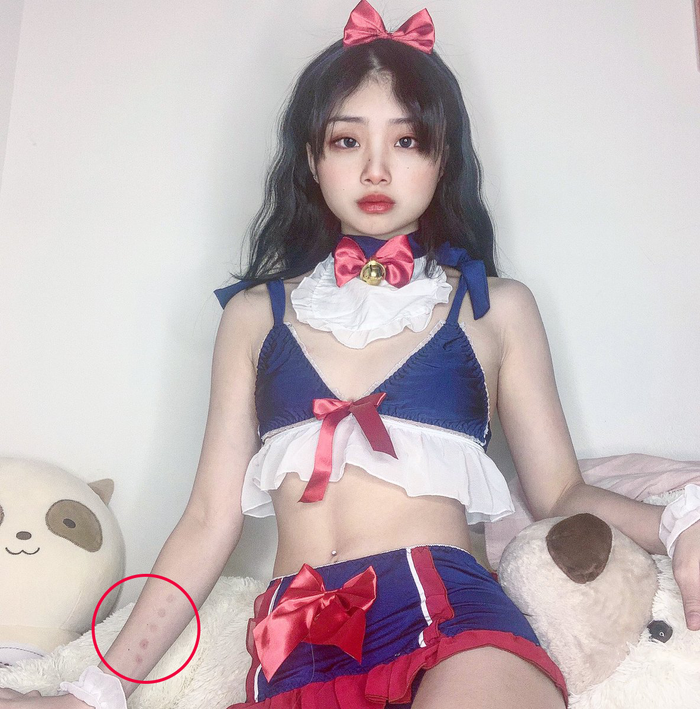 Những dấu vết đáng nghi ngờ trên cơ thể cô gái trẻ