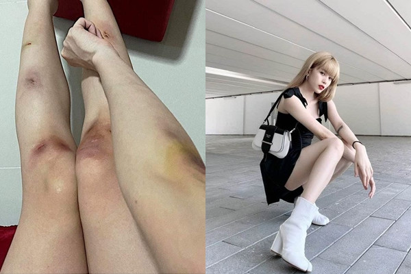 Kết quả sau quá trình tập luyện đó khiến người hâm mộ không khỏi xót xa. Cơ số vết thương nặng xuất hiện ở cả tay và chân, hầu như ở các khu vực đầu gối, ống đồng, khuỷu tay. Có thể thấy, lần này thay thế toàn bộ nét quyến rũ, nữ tính trước đó mà thay vào đó là hình ảnh mới mẻ hoàn toàn, 'chạm đến cảm xúc của mọi người' như cô chia sẻ.