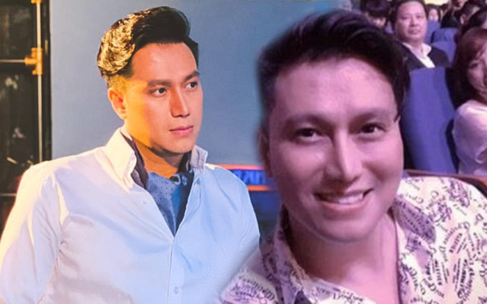 Việt Anh điển trai sau khi lộ gương mặt lạ lẫm hậu phẫu thuật thẩm mỹ Ảnh 2