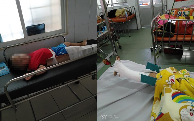 Bé trai 4 tuổi bị gãy chân ở lớp, cô giáo nói do 'chân quấn vào bàn' khiến người mẹ bức xúc Ảnh 2