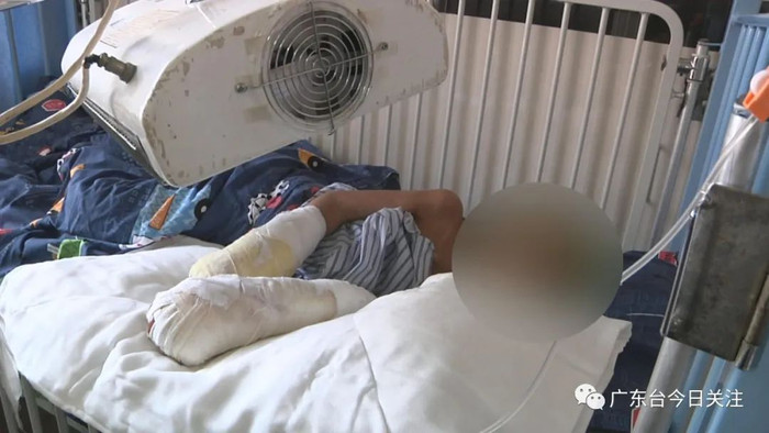 Bé trai 7 tuổi có thể phải cắt cụt tay do bị hoại tử. 