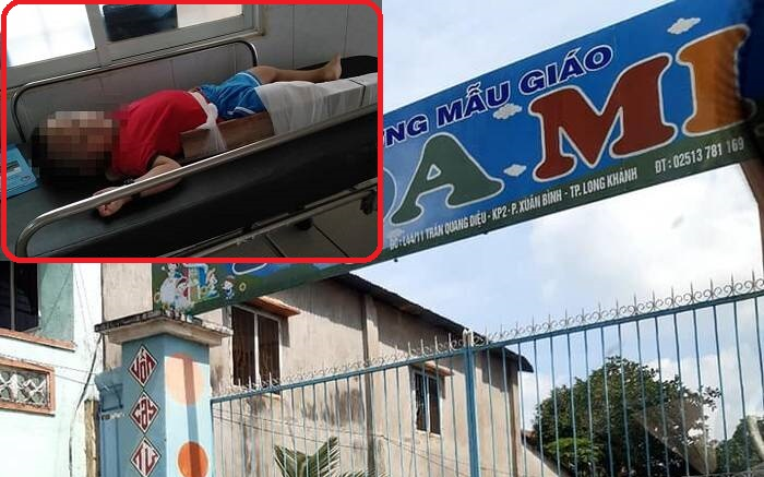 Vụ bé trai 4 tuổi bị gãy chân ở lớp: Cô giáo thừa nhận gác chân bé quặp lên cổ; quỳ khóc xin lỗi gia đình Ảnh 2